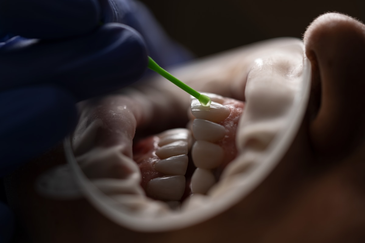 Dentist preparing dental veneers for patient